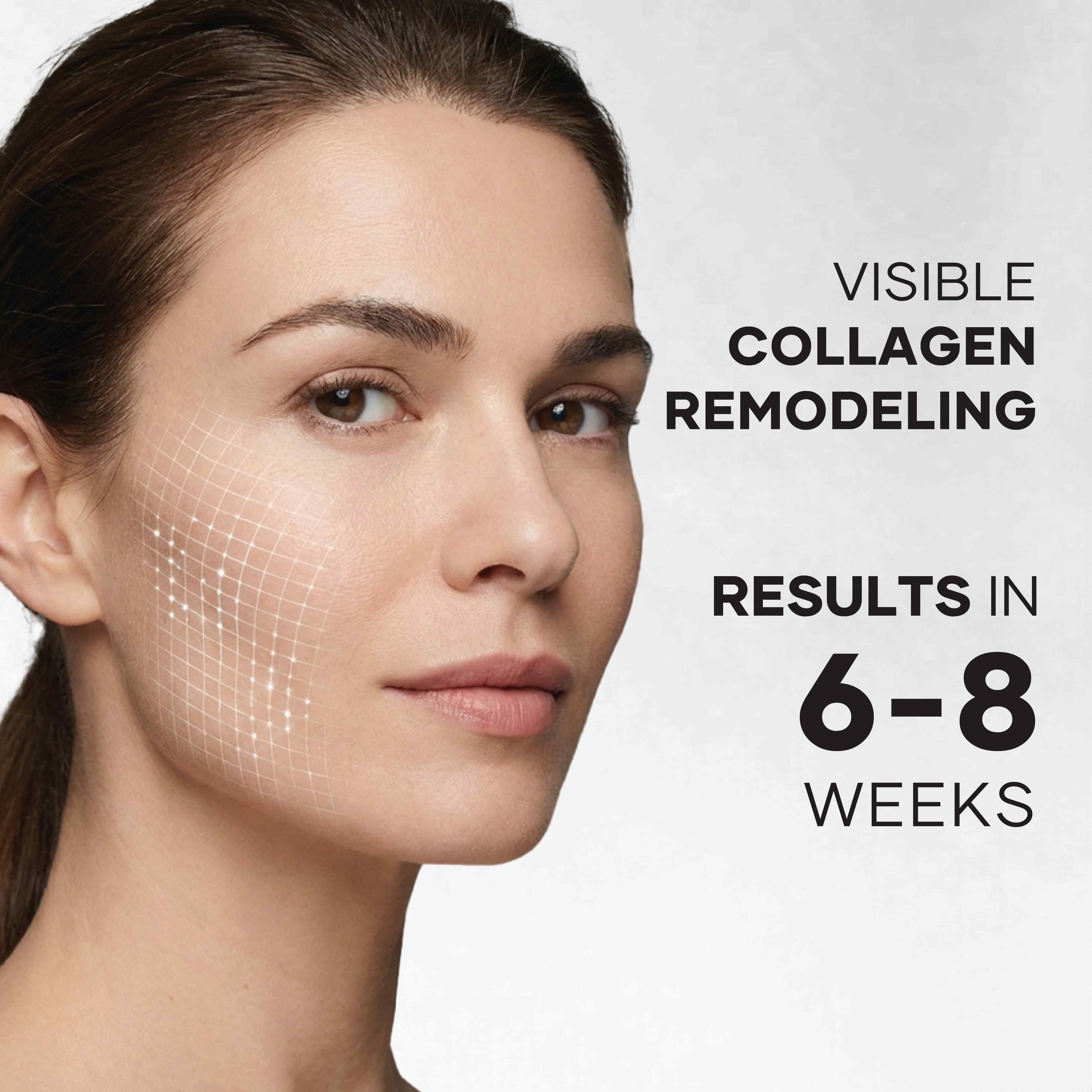 No.65 TOPICAL FILLER 4